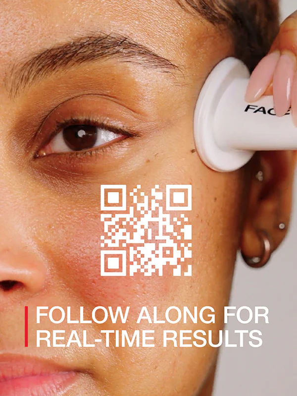 FACIAL CUPPING SET - Image 7